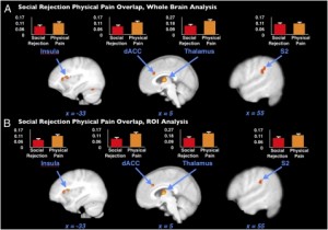 Rejection and physical pain